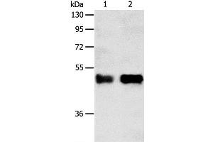 Western Blot analysis of Human liver cancer tissue and A549 cell using SERPINA5 Polyclonal Antibody at dilution of 1:750 (SERPINA5 antibody)