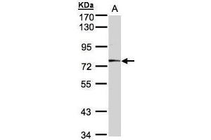 WB Image Sample(30 ug whole cell lysate) A:A431, 7. (MEP1A antibody)