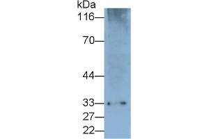 Detection of PD1 in Rat Spleen lysate using Polyclonal Antibody to Programmed Cell Death Protein 1 (PD1) (PD-1 antibody  (AA 41-132))