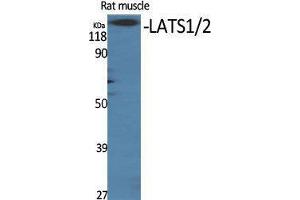 Western Blotting (WB) image for anti-LATS1,2 (Ser116) antibody (ABIN3180713) (LATS1,2 (Ser116) antibody)