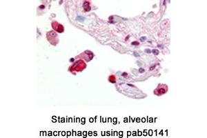 Image no. 1 for anti-ATP-Binding Cassette, Sub-Family G (WHITE), Member 1 (ABCG1) (AA 300-400), (Internal Region) antibody (ABIN363450) (ABCG1 antibody  (Internal Region))