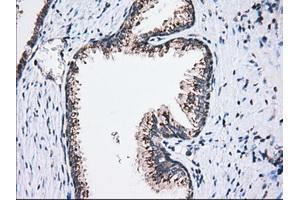 Immunohistochemical staining of paraffin-embedded Human liver tissue using anti-MOBKL1A mouse monoclonal antibody.