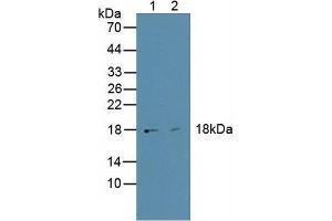 Western blot analysis of (1) Human HepG2 Cells and (2) Human BXPC-3 Cells. (HMGA1 antibody  (AA 3-107))
