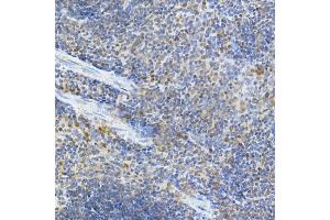 Immunohistochemistry (IHC) image for anti-Interferon Induced with Helicase C Domain 1 (IFIH1) (AA 1-205) antibody (ABIN6142174)