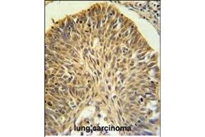 Immunohistochemistry (Paraffin-embedded Sections) (IHC (p)) image for anti-Leucine-Rich alpha-2 Glycoprotein 1 (LRG1) (AA 86-114), (N-Term) antibody (ABIN652229)