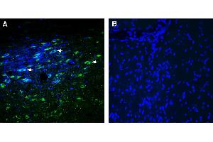 Expression of Glycine Receptor alpha 3 in rat substantia nigra pars compacta (SNC).