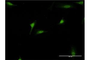 Immunofluorescence of monoclonal antibody to DEAF1 on HeLa cell. (DEAF1 antibody  (AA 133-222))