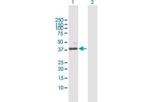 PLA2G15 Antikörper  (AA 1-412)