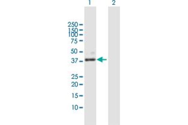 PLA2G15 Antikörper  (AA 1-412)
