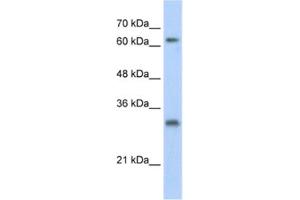 Western Blotting (WB) image for anti-Ubiquitin Specific Peptidase 39 (USP39) antibody (ABIN2461797) (USP39 antibody)