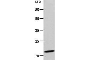 Western Blot analysis of 293T cell using DUT Polyclonal Antibody at dilution of 1:500 (Deoxyuridine Triphosphatase (DUT) antibody)