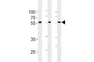 Western blot analysis in 293,A549,Ramos cell line lysates (35ug/lane). (TRIM6 antibody  (N-Term))