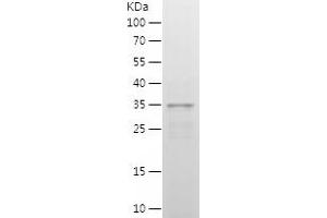 Western Blotting (WB) image for Interferon Regulatory Factor 2 (IRF2) (AA 60-349) protein (His tag) (ABIN7283039) (IRF2 Protein (AA 60-349) (His tag))