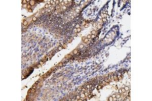 IHC analysis of FOSB using anti-FOSB antibody (ABIN3042399).