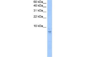 WB Suggested Anti-SEPT6(septin 6) Antibody Titration:  0.