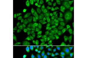 Immunofluorescence analysis of A549 cells using NAA50 Polyclonal Antibody (NAA50 antibody)