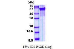 Figure annotation denotes ug of protein loaded and % gel used. (ARSG Protein)