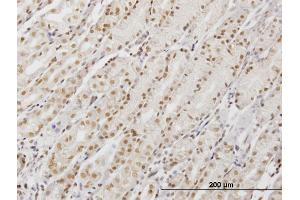 Immunoperoxidase of monoclonal antibody to DDX54 on formalin-fixed paraffin-embedded human stomach. (DDX54 antibody  (AA 778-881))
