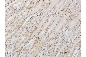Immunoperoxidase of monoclonal antibody to DDX54 on formalin-fixed paraffin-embedded human stomach.