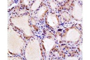 Formalin-fixed and paraffin embedded rat thyroid gland labeled with Anti-NIS Polyclonal Antibody, Unconjugated  at 1:200, followed by conjugation to the secondary antibody and DAB staining (SLC5A5 antibody  (AA 525-618))