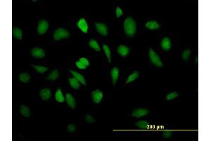 Immunofluorescence of purified MaxPab antibody to EEF1E1 on HeLa cell. (EEF1E1 antibody  (AA 1-174))