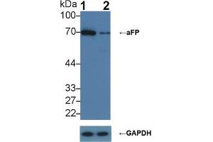 Knockout Varification: ;Lane 1: Wild-type HepG2 cell lysate; ;Lane 2: aFP knockout HepG2 cell lysate; ;Predicted MW: 69kDa ;Observed MW: 70kDa;Primary Ab: 2µg/ml Rabbit Anti-Human aFP Ab;Second Ab: 0. (alpha Fetoprotein antibody  (AA 31-171))
