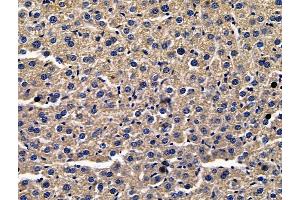 ABIN7096708 and ABIN7100773 at 1/100 staining mouse liver tissue by IHC-P. (SERPINA7 antibody)