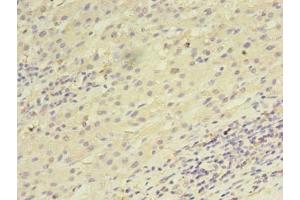Immunohistochemistry (IHC) image for anti-UTP23, Small Subunit (SSU) Processome Component, Homolog (UTP23) (AA 1-249) antibody (ABIN7168458)