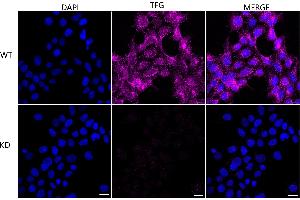 anti-Trk-Fused Gene (TFG) antibody
