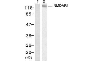 Western blot analysis of extract from mouse brain tissue, using NMDAR1 (Ab-896) Antibody (E021133, Lane 1 and 2). (GRIN1/NMDAR1 antibody)