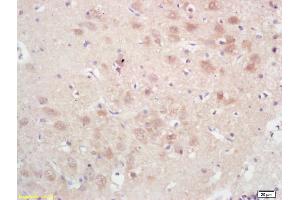 Formalin-fixed and paraffin embedded rat brain labeled with Rabbit Anti GPAM Polyclonal Antibody, Unconjugated (ABIN709121) at 1:200 followed by conjugation to the secondary antibody and DAB staining (GPAM antibody  (AA 611-710))