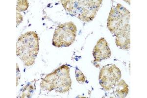 Immunohistochemistry of paraffin-embedded Human stomach using STK3 Polyclonal Antibody at dilution of 1:100 (40x lens). (STK3 antibody)