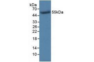 Figure. (TK1 antibody  (AA 2-234))