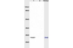Lane 1: mouse brain lysates Lane 2: human colon carcinoma lysates probed with Anti SNAP25 Polyclonal Antibody, Unconjugated (ABIN738111) at 1:200 in 4 °C. (SNAP25 antibody  (AA 166-206))
