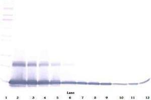 Image no. 3 for anti-Chemokine (C-C Motif) Ligand 9 (Ccl9) antibody (ABIN465416) (CCL9 antibody)