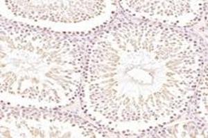 Immunohistochemistry analysis of paraffin-embedded mouse testis using,PARIS (ABIN7076272) at dilution of 1: 3000