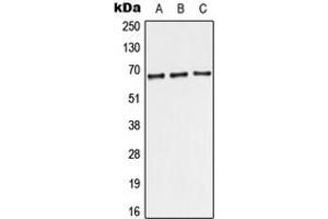Western blot analysis of TRF2 expression in MCF7 (A), Raw264. (TBPL1 antibody  (Center))