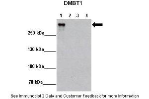 Lanes:   Lane 1: 2ug MCF7-DMBT1+Dox Lane 2: 2ug MCF7-DMBT1 -Dox Lane 3: 2ug MCF7-Ctrl+Dox Lane 4: 2ug MCF7-DMBT1 -Dox  Primary Antibody Dilution:    1:5000  Secondary Antibody:   Anti-rabbit HRP  Secondary Antibody Dilution:    1:10,000  Gene Name:   DMBT1  Submitted by:   Matthias Rauen, Lundbeckfonden Center of Excellence NanoCAN, University of Southern Denmark (DMBT1 antibody  (N-Term))