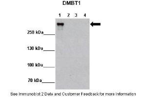 Lanes:   Lane 1: 2ug MCF7-DMBT1+Dox Lane 2: 2ug MCF7-DMBT1 -Dox Lane 3: 2ug MCF7-Ctrl+Dox Lane 4: 2ug MCF7-DMBT1 -Dox  Primary Antibody Dilution:    1:5000  Secondary Antibody:   Anti-rabbit HRP  Secondary Antibody Dilution:    1:10,000  Gene Name:   DMBT1  Submitted by:   Matthias Rauen, Lundbeckfonden Center of Excellence NanoCAN, University of Southern Denmark