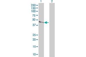 Western Blot analysis of PARVB expression in transfected 293T cell line by PARVB monoclonal antibody (M01), clone 4A11. (Parvin, beta antibody  (AA 1-350))