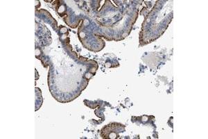 Immunohistochemical staining (Formalin-fixed paraffin-embedded sections) of human duodenum with SFXN5 polyclonal antibody  shows cytoplasmic and membranous positivity in glandular cells at 1:50-1:200 dilution. (Sideroflexin 5 antibody)