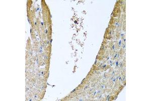 Immunohistochemistry of paraffin-embedded mouse heart using COX5B antibody. (COX5B antibody  (AA 32-129))