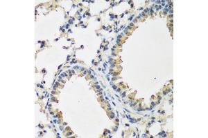 Immunohistochemistry of paraffin-embedded mouse lung using BMP2 antibody (ABIN5970060) at dilution of 1/200 (40x lens).