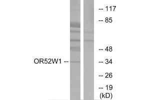 Western blot analysis of extracts from HeLa cells, using OR52W1 antibody. (OR52W1 antibody  (C-Term))