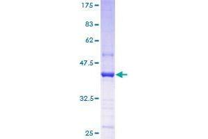 TGS1 Protein (AA 1-141) (GST tag)
