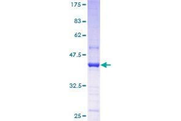 TGS1 Protein (AA 1-141) (GST tag)