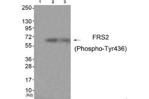 Western blot analysis of extracts from HuvEc cells (Lane 2) and JK cells (Lane 3), using FRS2 (Phospho-Tyr436) Antibody.