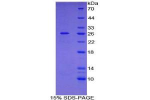 SDS-PAGE analysis of Human Filamin C gamma Protein. (FLNC Protein)