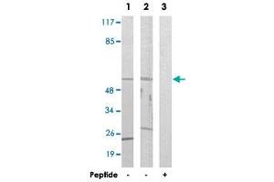 Western blot analysis of extracts from LoVo cells (Lane 1 and lane 3) and HUVEC cells (Lane 2), using CYP39A1 polyclonal antibody . (CYP39A1 antibody)