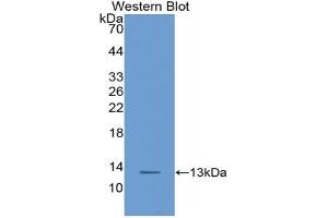 Western blot analysis of the recombinant protein. (CXCL14 antibody  (AA 23-99))